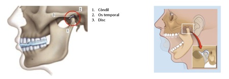 Articulació temporomandibular